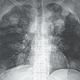 Image for article titled Horrified Doctors Find "Crazy" Tapeworm Cancer in Patient’s Brain